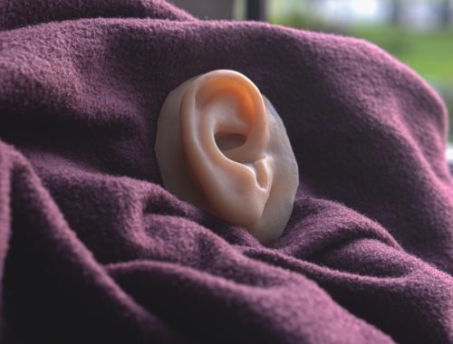 prótesis de oído