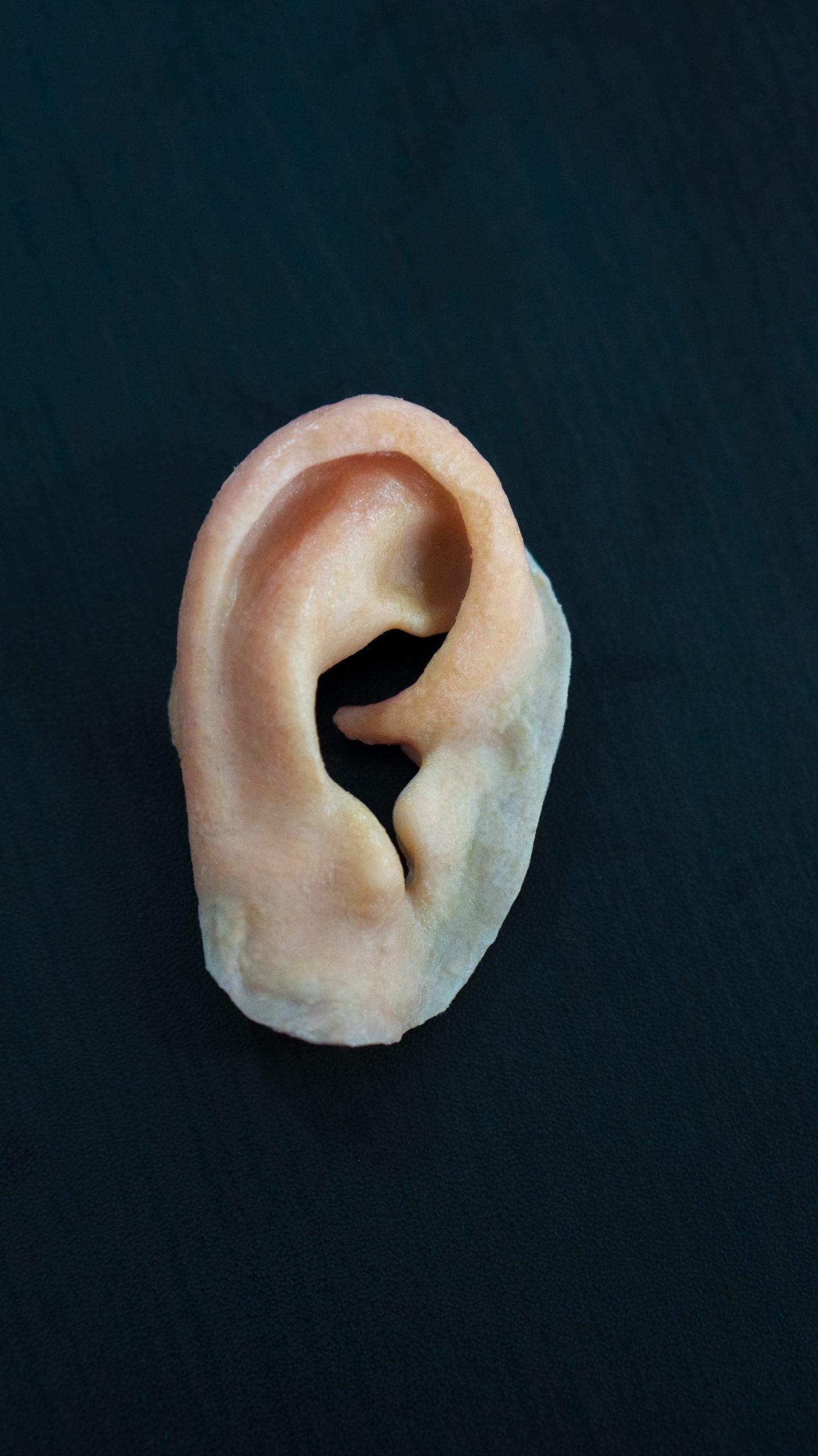 Prótesis de oído, prótesis de microtia, prótesis de pabellón auricular